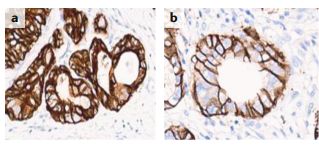 her2靶向治疗新思考,her-2靶向药