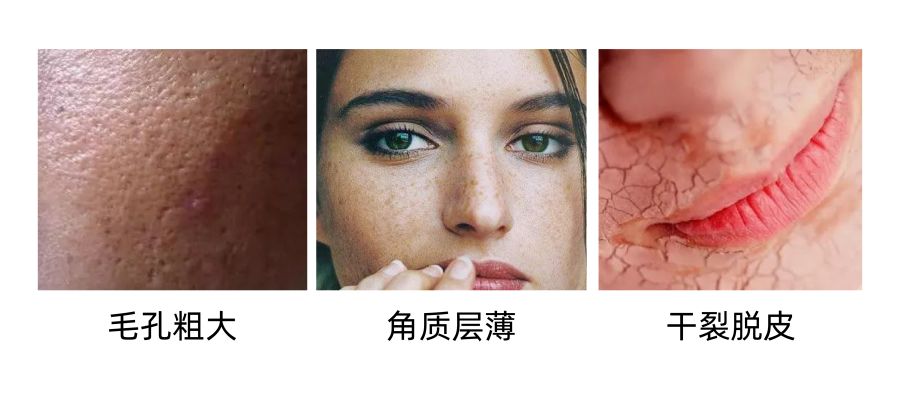 洗脸仪会对皮肤有伤害吗,洗脸仪真的假的