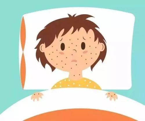 关于水痘高发期怎么预防,水痘高发期注意什么