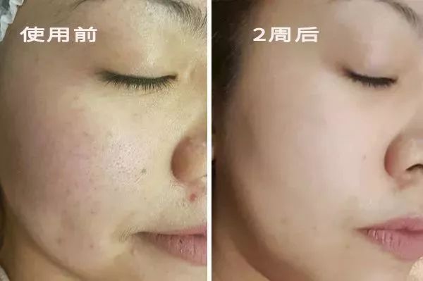 给肠道洗个澡，便秘、口臭、大肚腩都没了