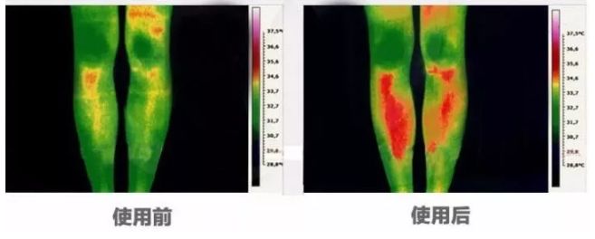穿衣小技巧冬天这样穿很显腿长,冬天光腿神器穿搭