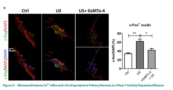 超声神经调控2020,超声神经调控视频