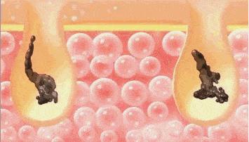 无痛搓泥|日系变态搓澡巾！轻轻搓一搓，泥条劈里啪啦的掉