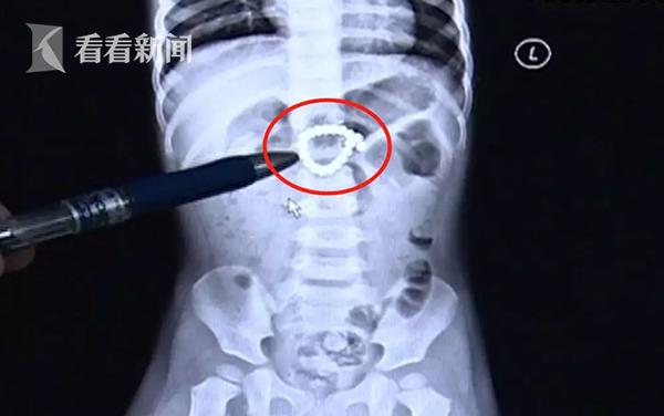 8岁男童胀气又吐又拉水肚子痛,8岁男童突然肚子疼还吐了