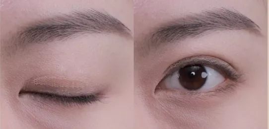 angelababy的双眼皮是什么情况,angelababy的脸整过容吗