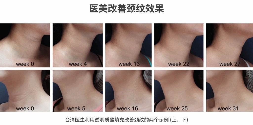 想要更耐老注意这个细节,想要更耐老注意这5个细节