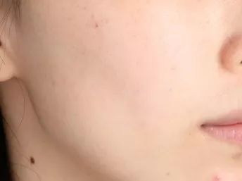 洗劫了编辑部后才发现，她们的面膜都这么好用