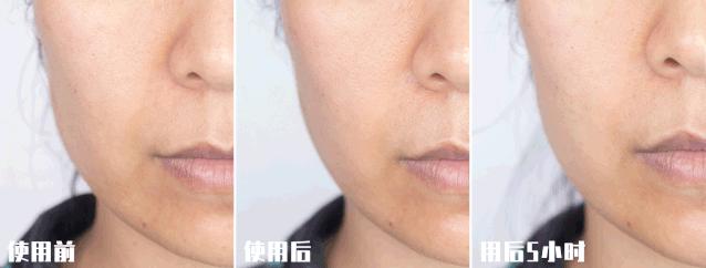 推广一个月没有任何效果,美容院脸部抗衰提拉紧致手法