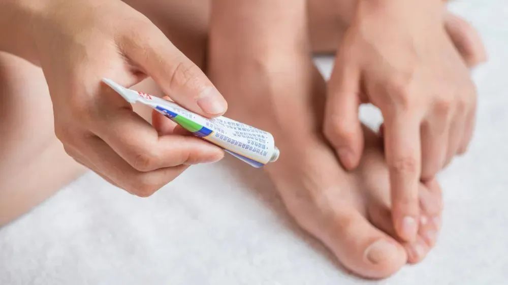 我的脚气好多年了怎样才能治好,怎么能把脚气彻底治疗好