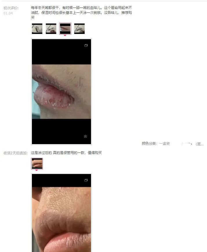 嘴唇干裂起皮等皮掉了涂唇膏,嘴唇干脱皮用什么唇部护理比较好?