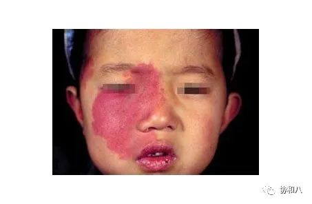 复习这些名解时总觉得怪饿的|协和八·脑洞大开