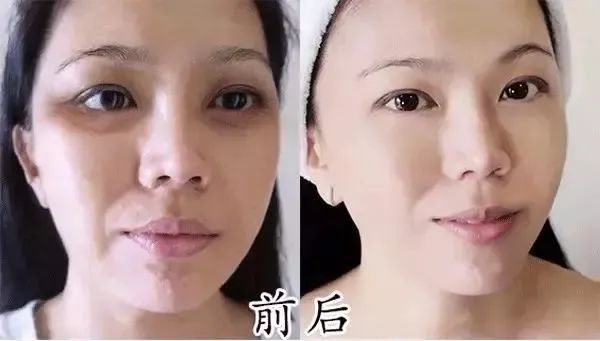 各类肌肤的实用美白技巧,美白牛奶肌的秘密在这里