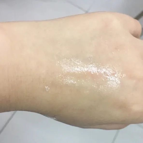 十大皮肤问题,所有皮肤问题都能解决