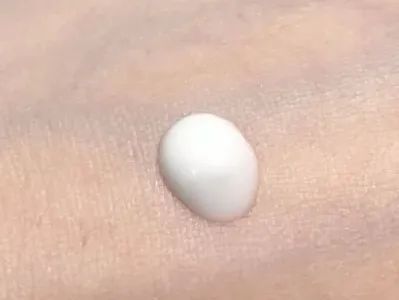 100个皮肤问题案例,世界上十大皮肤顽疾