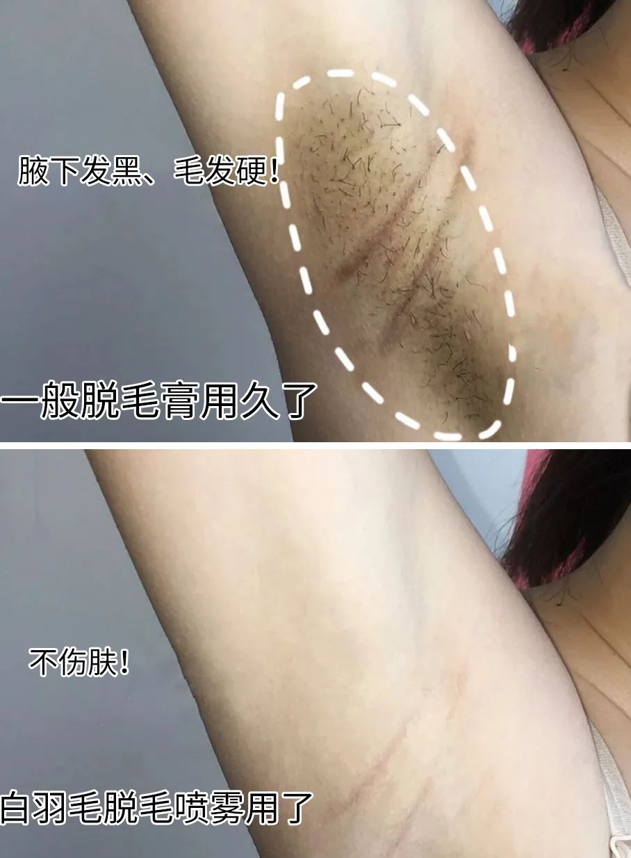 光滑无暇|黑丑的“毛裤腿”，用它，10分钟“脱”得一干二净，肌肤光滑细腻