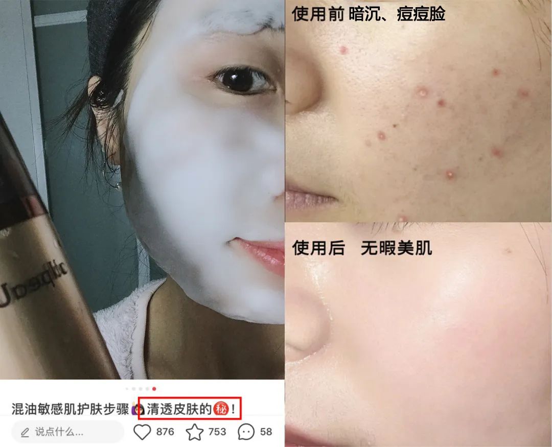 洗出脸上的脏东西解压,清除脸上斑块的产品