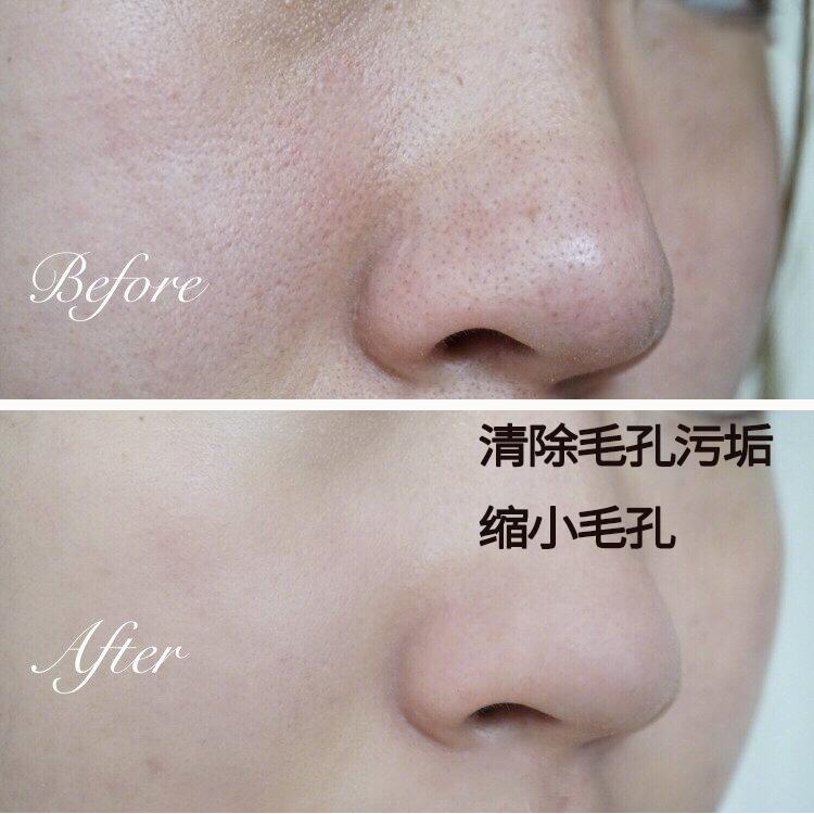 洗出脸上的脏东西解压,清除脸上斑块的产品