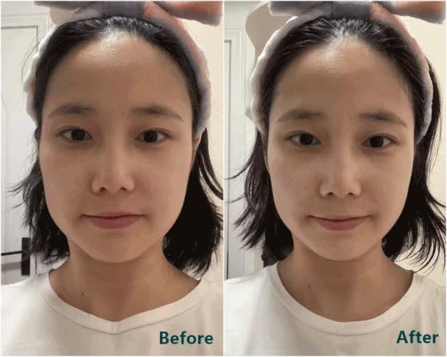 推广一个月没有任何效果,美容院脸部抗衰提拉紧致手法