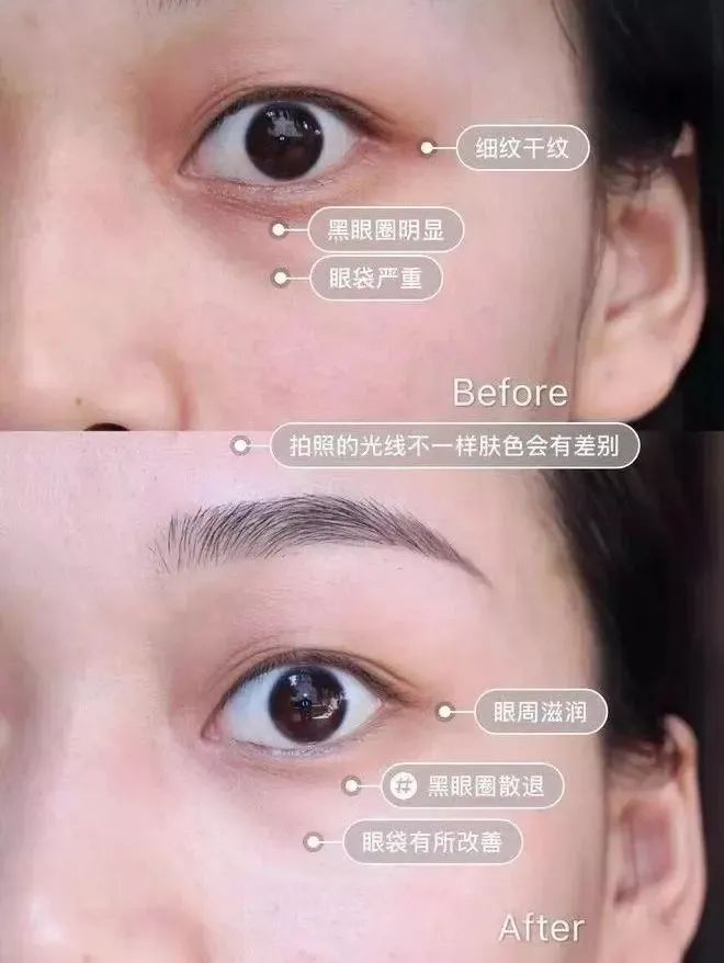 喝胶原蛋白要坚持多久才能有效果,紧急提醒经常喝这个的人要注意了