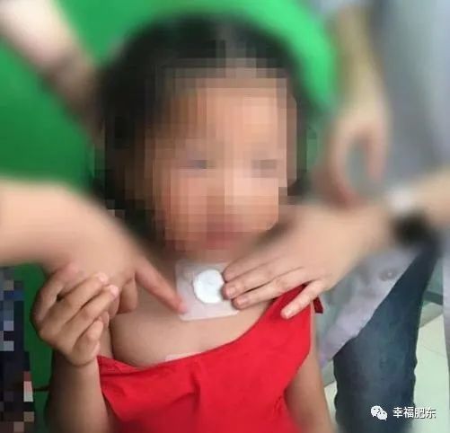 合肥再添一所三甲医院,肥东县中医院冬病夏治