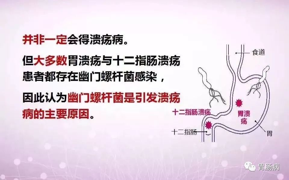 幽门螺杆菌的科普合集,hp幽门螺杆菌症状