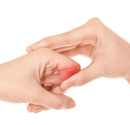 教你4招轻松应对风湿性关节炎痛,用什么方法缓解风湿