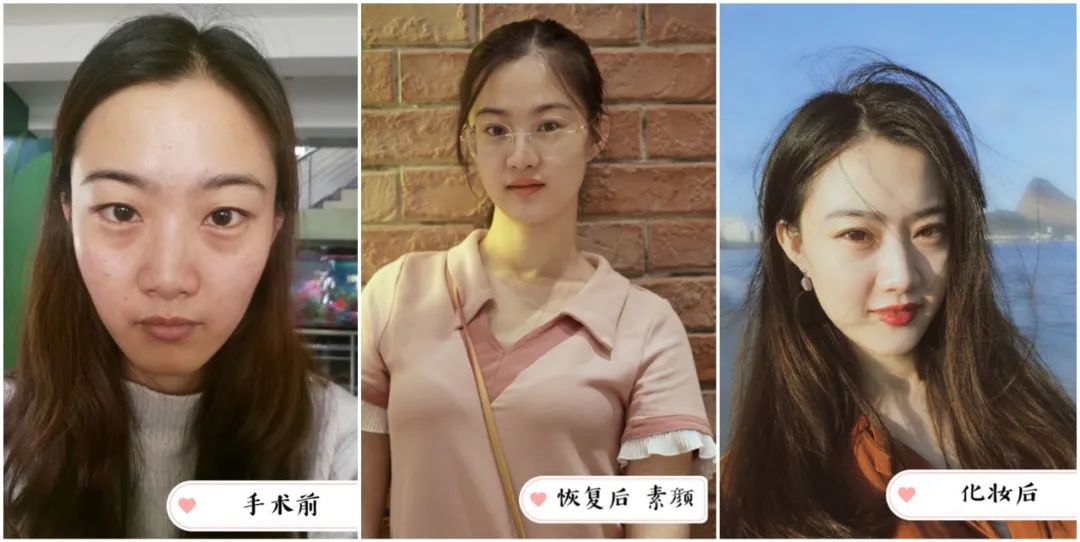 做完医美用可复美吗,你知道做完医美有多可怕