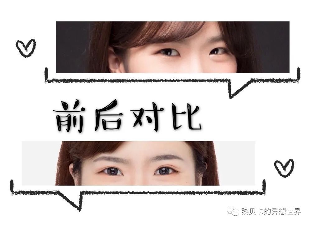 做完医美真的能换脸吗,做完医美需要注意什么