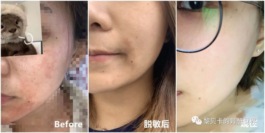 做完医美真的能换脸吗,做完医美需要注意什么