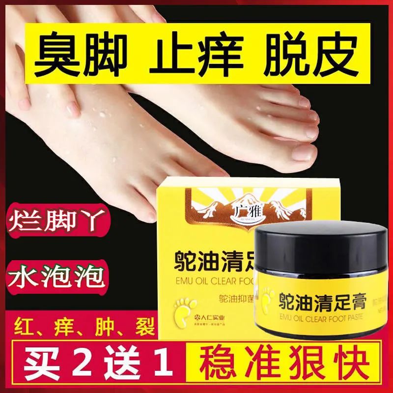 冬天脱鞋脚臭怎么办,长时间没办法脱鞋怎么防止脚臭