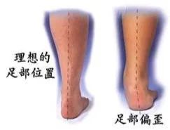 手足外科微创手术,巴彦淖尔市医院手足显微外科