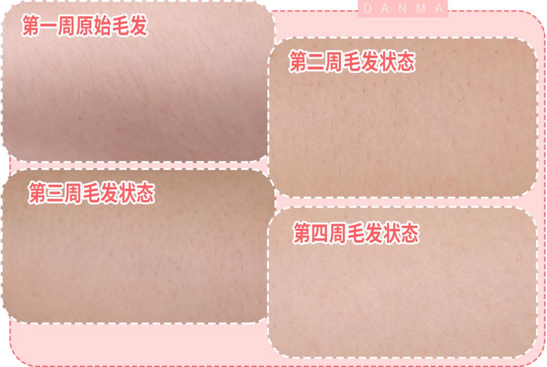 超良心真人测评！花了28天，告诉你脱毛仪到底值不值得买|辣妈研究所065