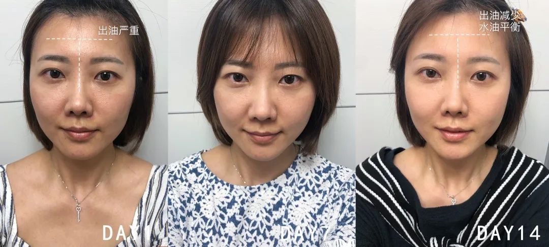 百人测评团|蒸笼天里,想让肌肤“一秒入水”,可能吗?