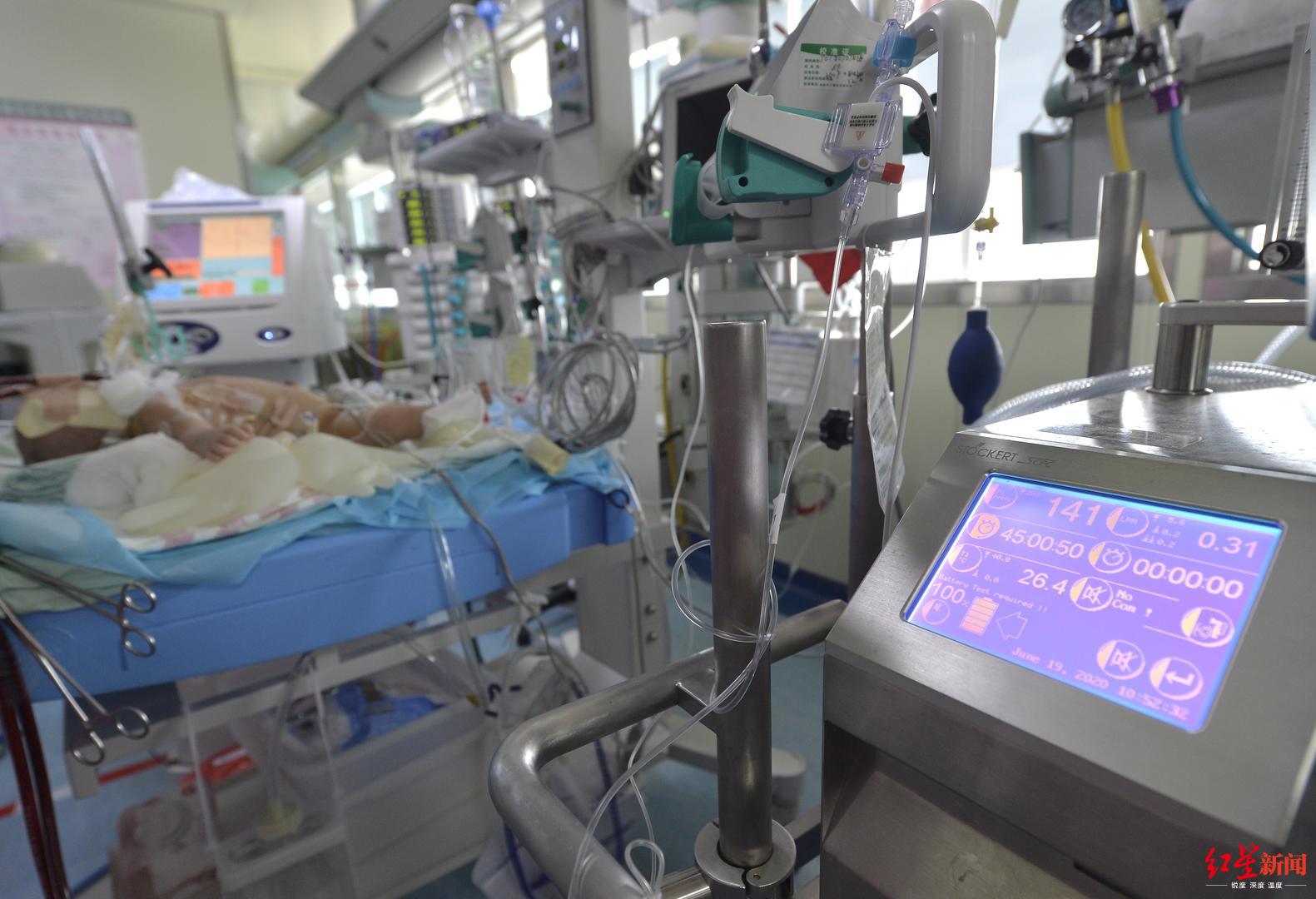 ecmo抢救新生儿,新生儿ecmo抢救无效纪录片