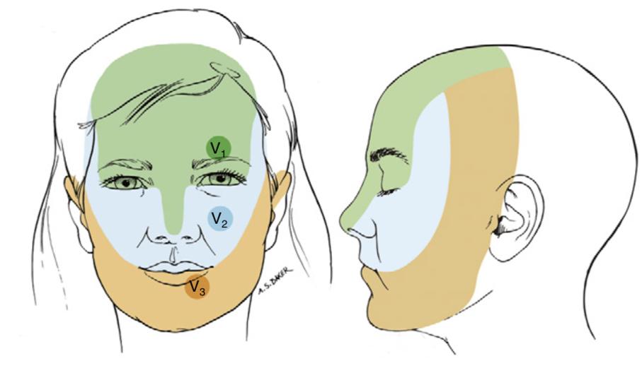 华西医学院治三叉神经的效果好吗,有什么方法治愈三叉神经痛