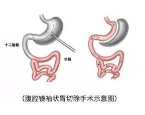 一条公式告诉你到底算不算胖,怎么算你是胖还是瘦的公式