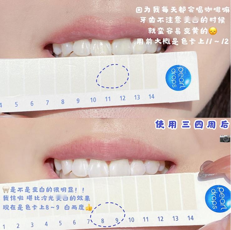 牙齿变黄你真的刷对了吗,牙齿黄了怎么办不用花钱去洗牙