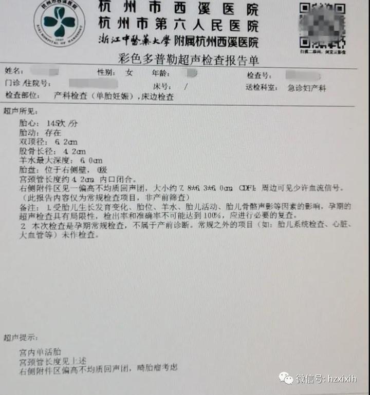 二胎宝妈卵巢囊肿,二胎妈妈检查出肿瘤