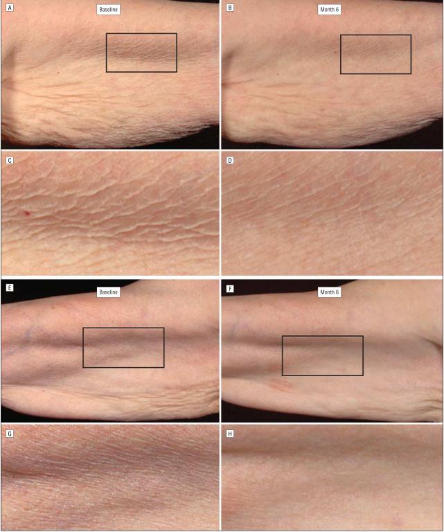 脸上长皱纹怎么办,手长皱纹怎么办