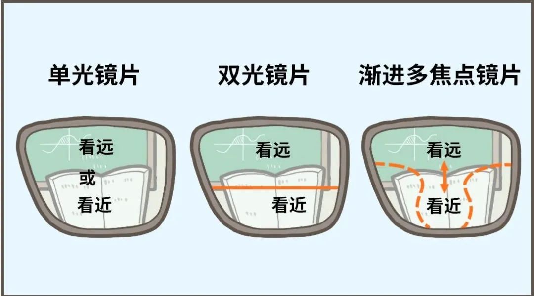 小学生150度近视还可以矫正视力吗,儿童近视视力矫正训练靠谱吗