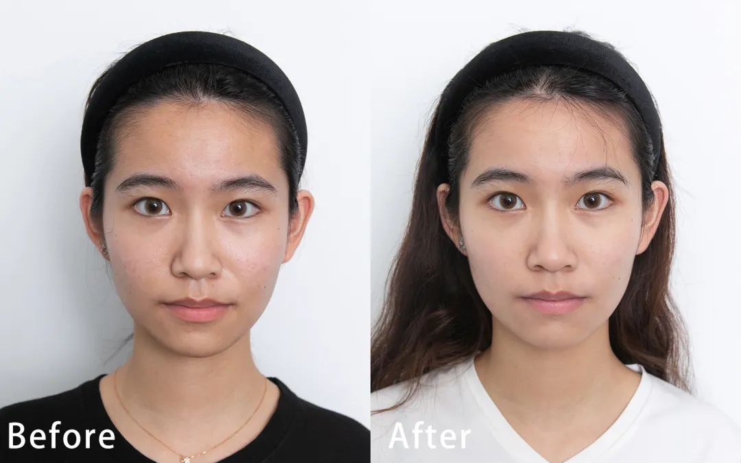 三明治敷面膜的方法,三明治敷面膜法