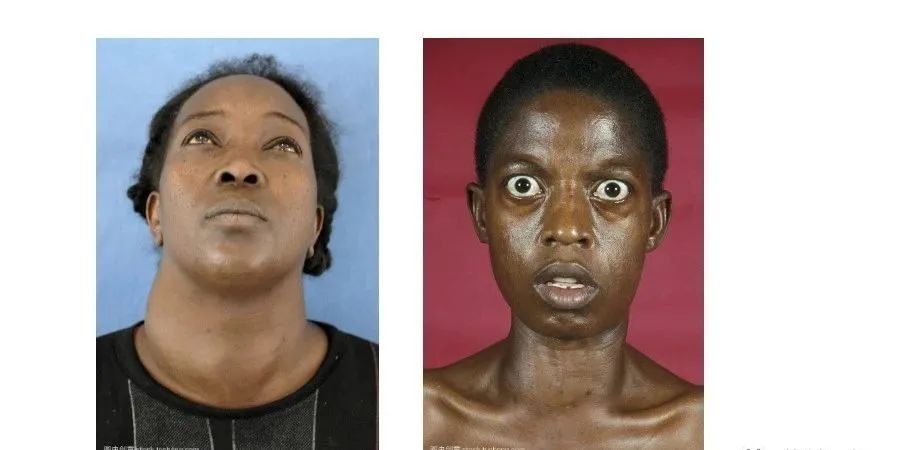 鏁欒偛鏁撮】鎴掓瘨,鏁欒偛鏁撮】绂佹瘨