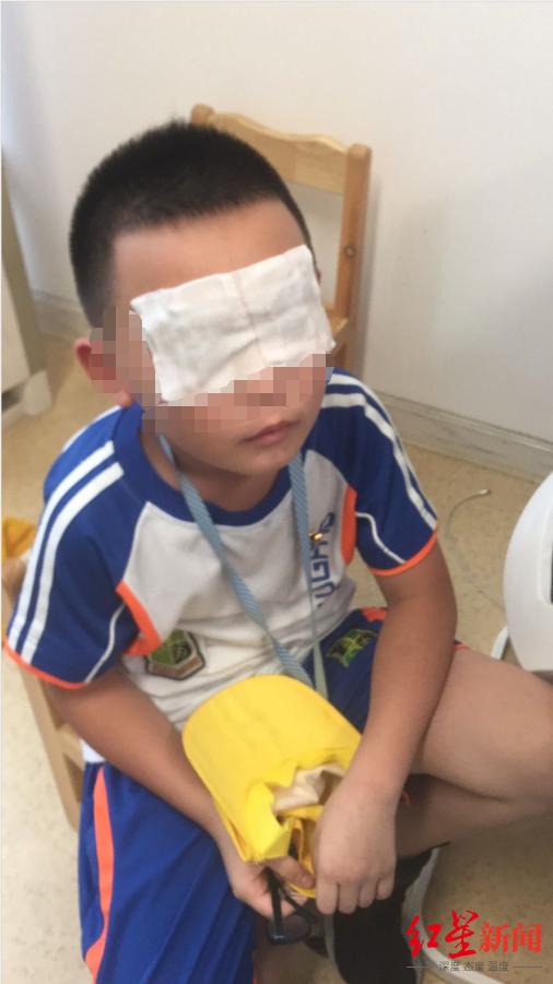 学校紫外线灼伤事件,一小学生误开紫外线灯5小时