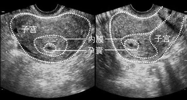 怎样读懂多普勒超声报告单,健康监测体检报告单