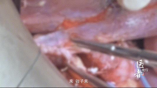 【预告】我时常面临下不来台的危险