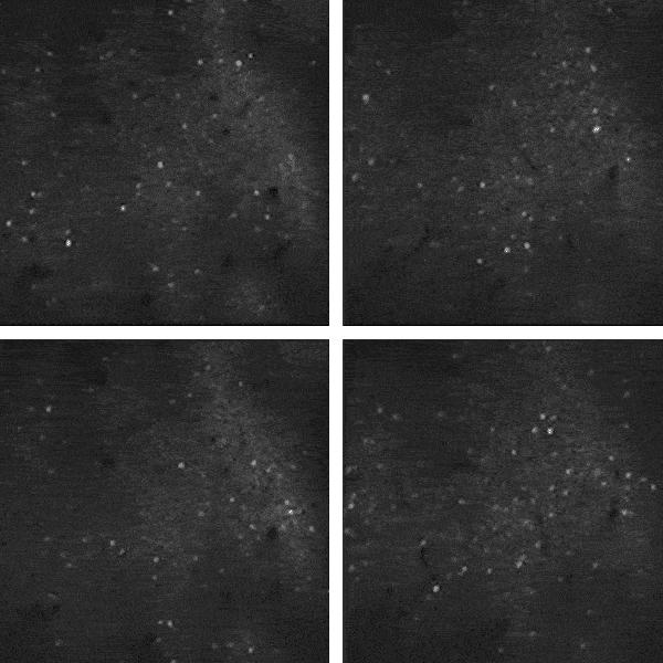 睡觉有噪音对大脑有影响吗,旁边经常有噪音对大脑有什么危害