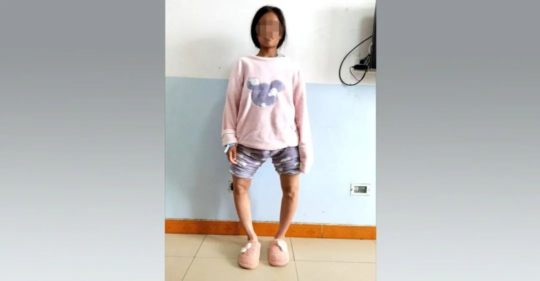 截骨手术是什么手术全过程,截骨矫形手术全过程