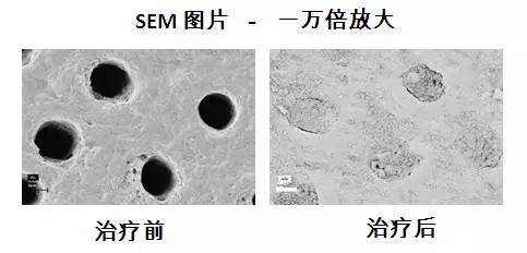 瑞士国民牙膏治牙敏感,牙齿酸用抗敏感牙膏有效