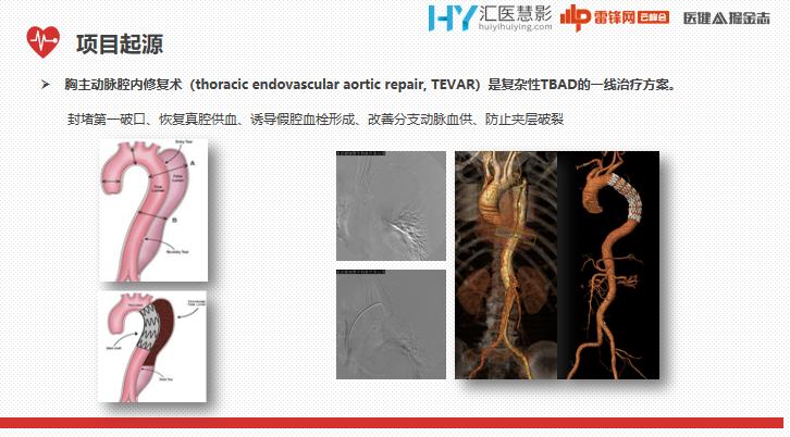 ai辅助医生心血管疾病诊断效率,ai技术治疗心血管疾病