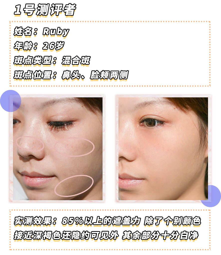 爱长斑的女人怎么办,女生长斑